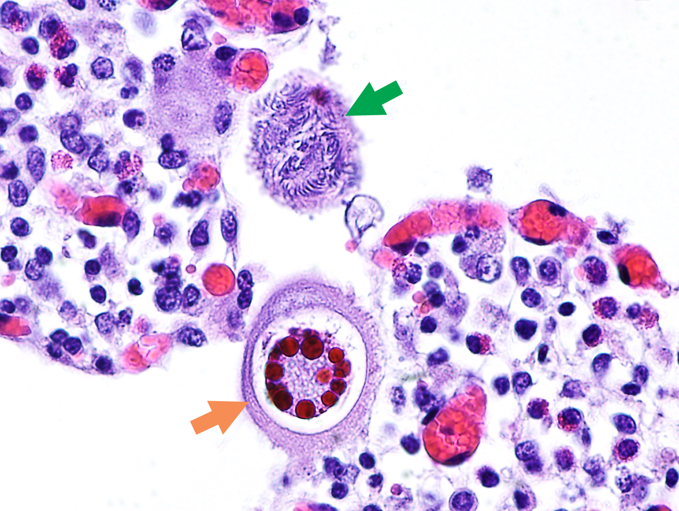 Coccidial microgamonts (green arrow) and macrogamonts (orange arrow) in the intestinal villi of an animal with severe coccidiosis. Photo: Cosme Sánchez-Miguel.