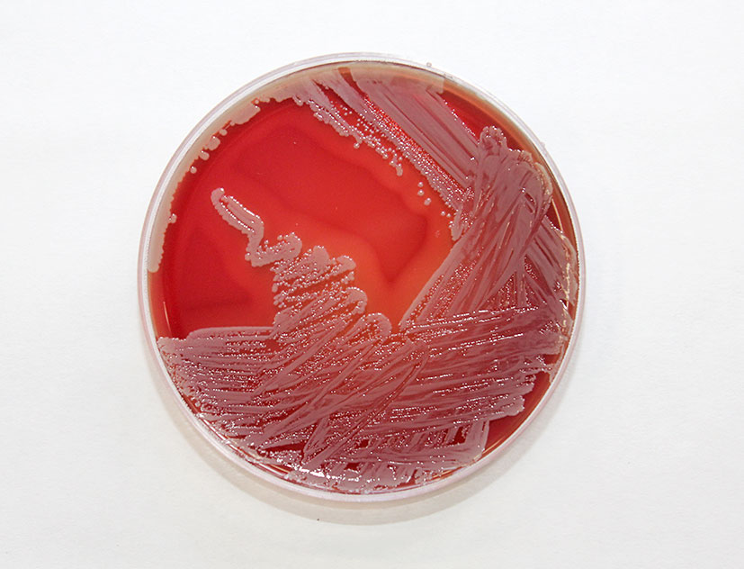  Staphylococcus aureus growing on a blood agar plate. Photo: Alan Johnson.