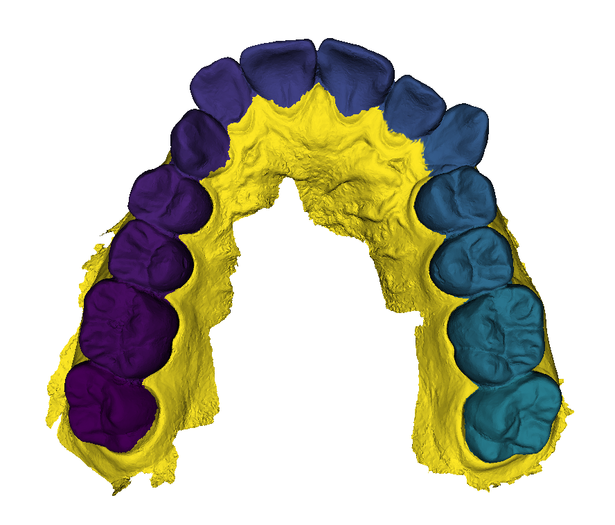 Example of a jaw model