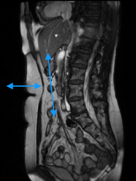 Visceral slide scheme