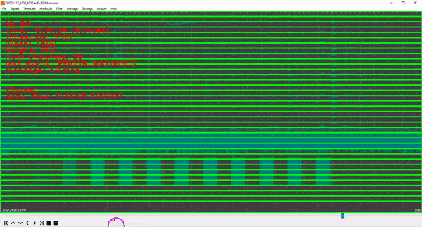 GIF showing TEETACSI's tracking of eye gaze relative to on-screen EEG signals.