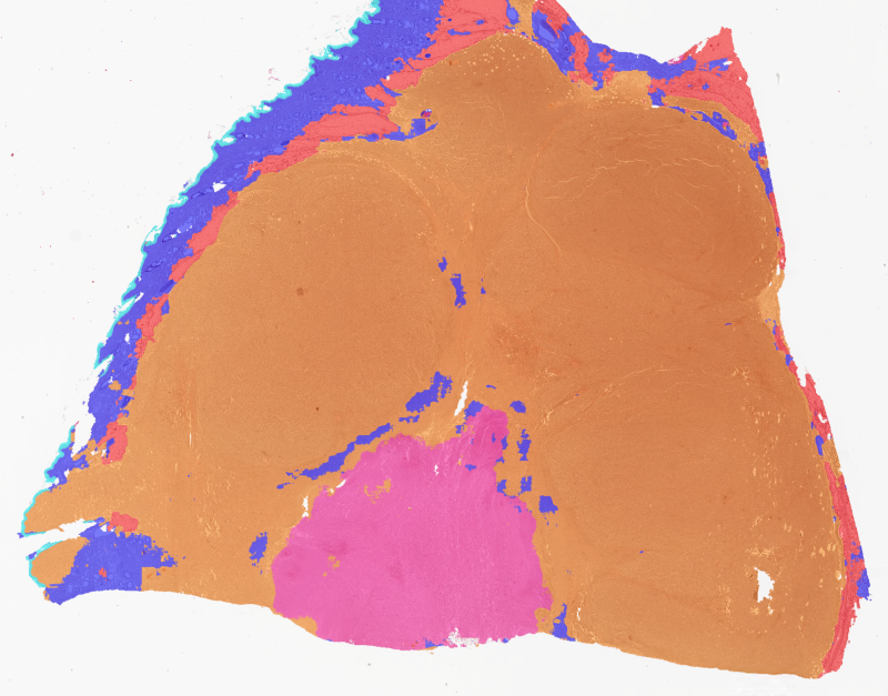 Segmentation prediction