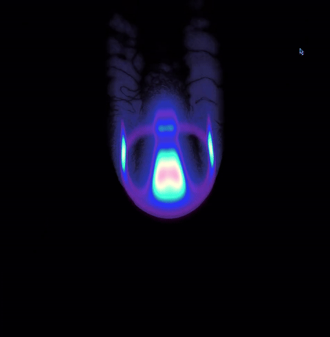 Orbium Unicaudatus