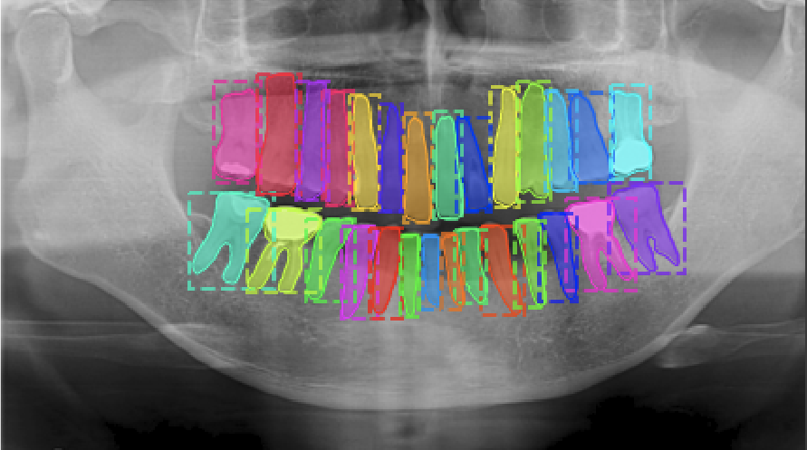 Nucleus Segmentation