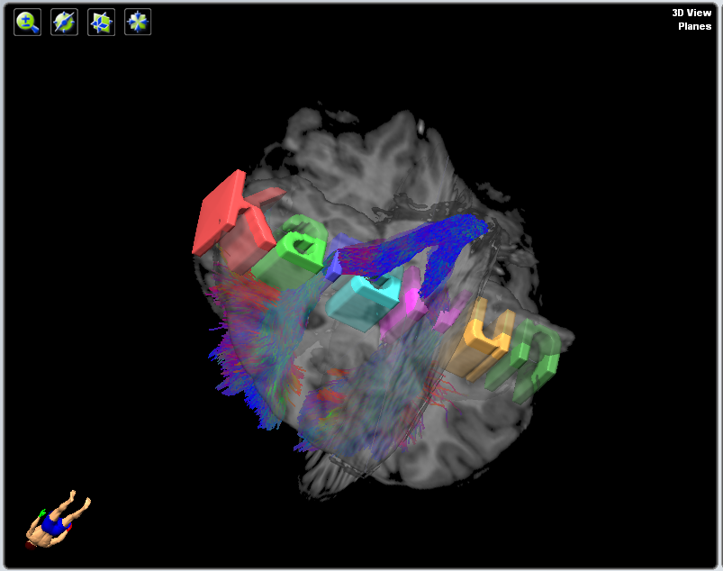 Brainlab objects