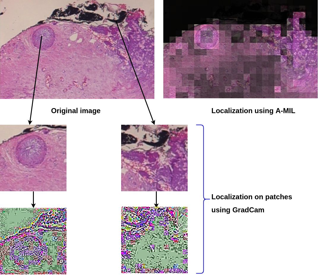 Comparison of the visualization output of Grad-CAM and A-MIL