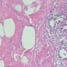 Input histopathology patch