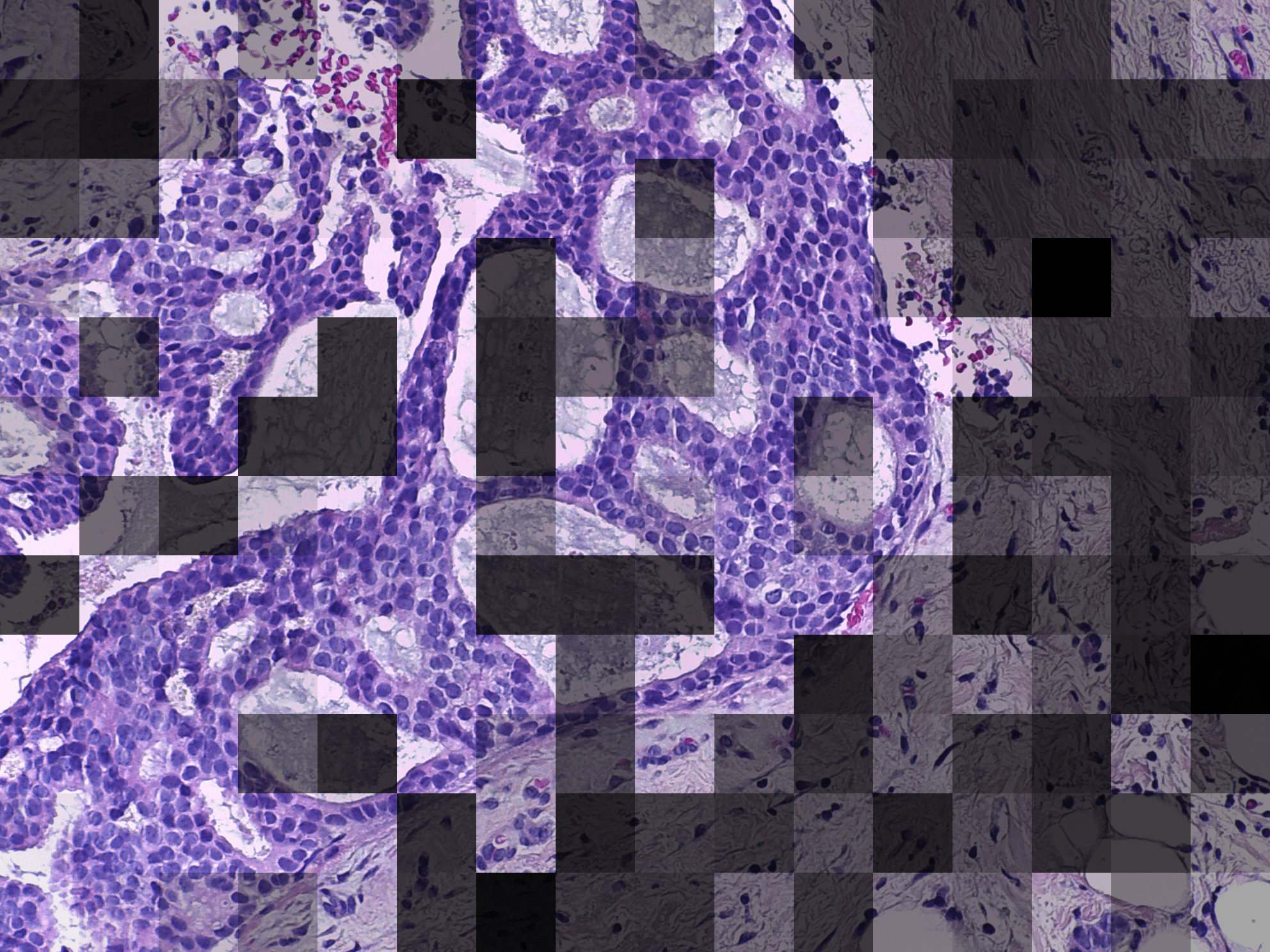 A-MIL localization on a BACH image