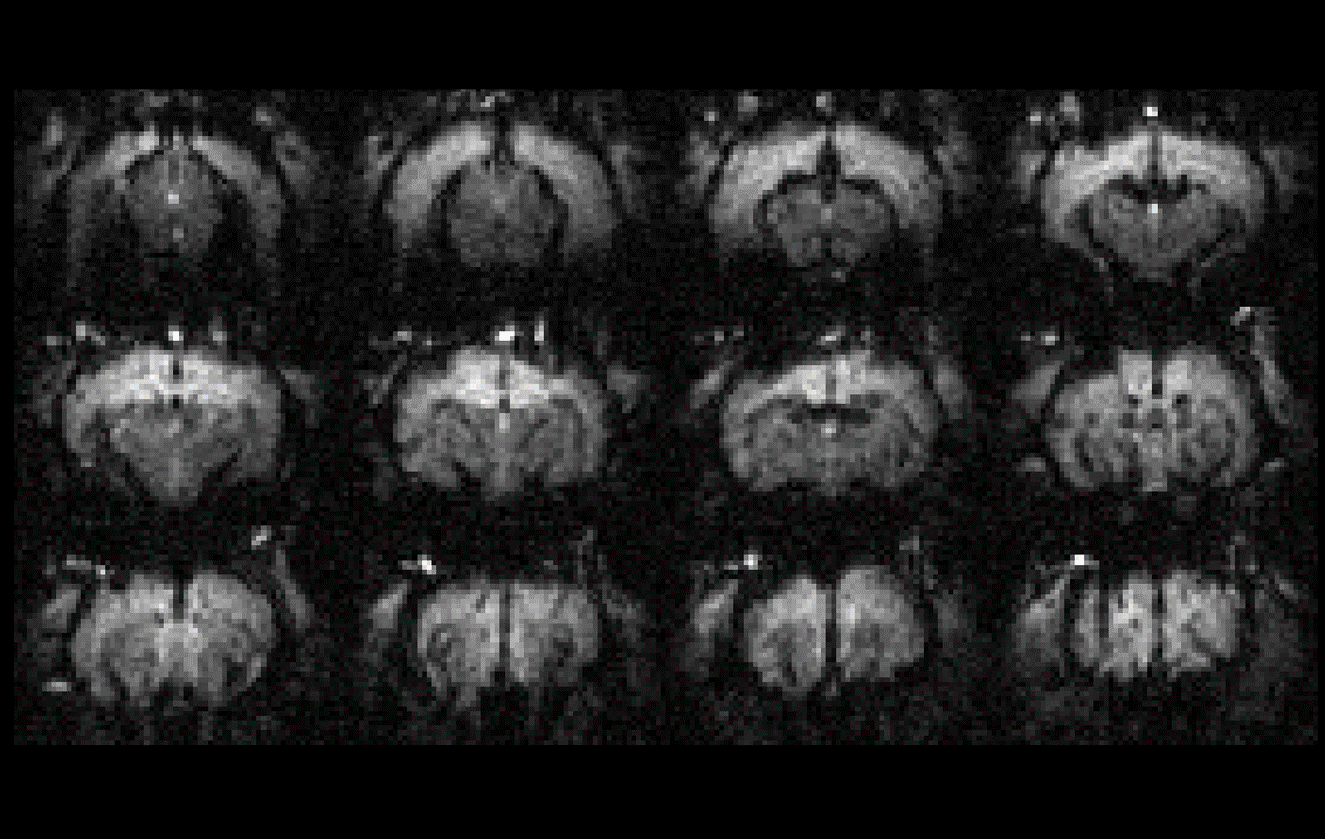 Quick MRI Visualizer project preview