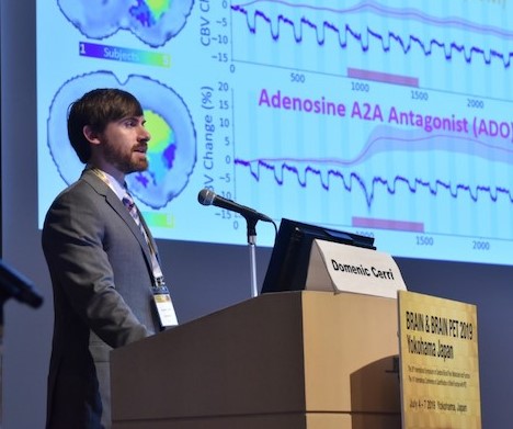 Picture of Dom giving a talk at the JCBFM 2019 Niels Lassen Award Session in Yokohama, Japan