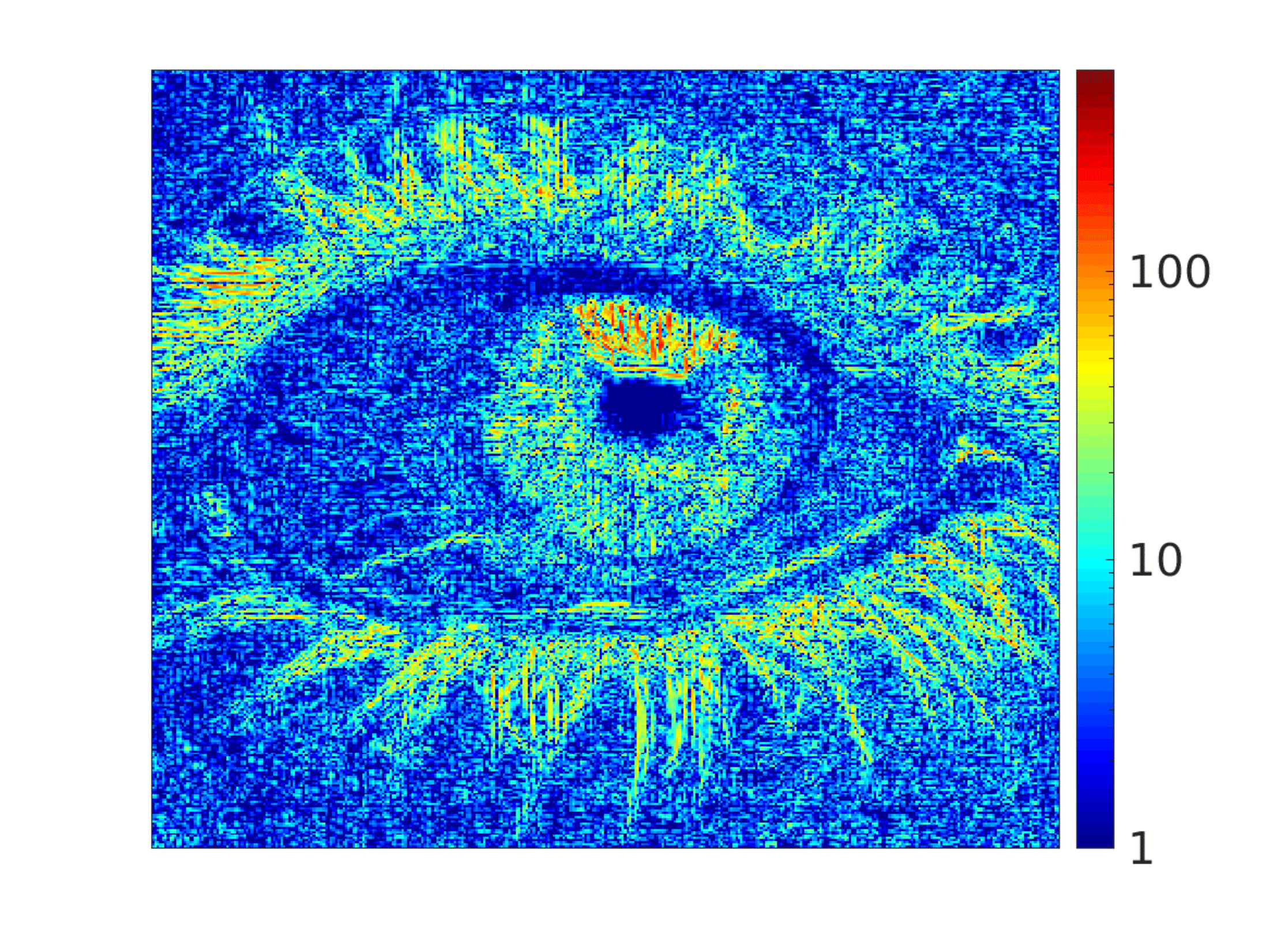 interpolation