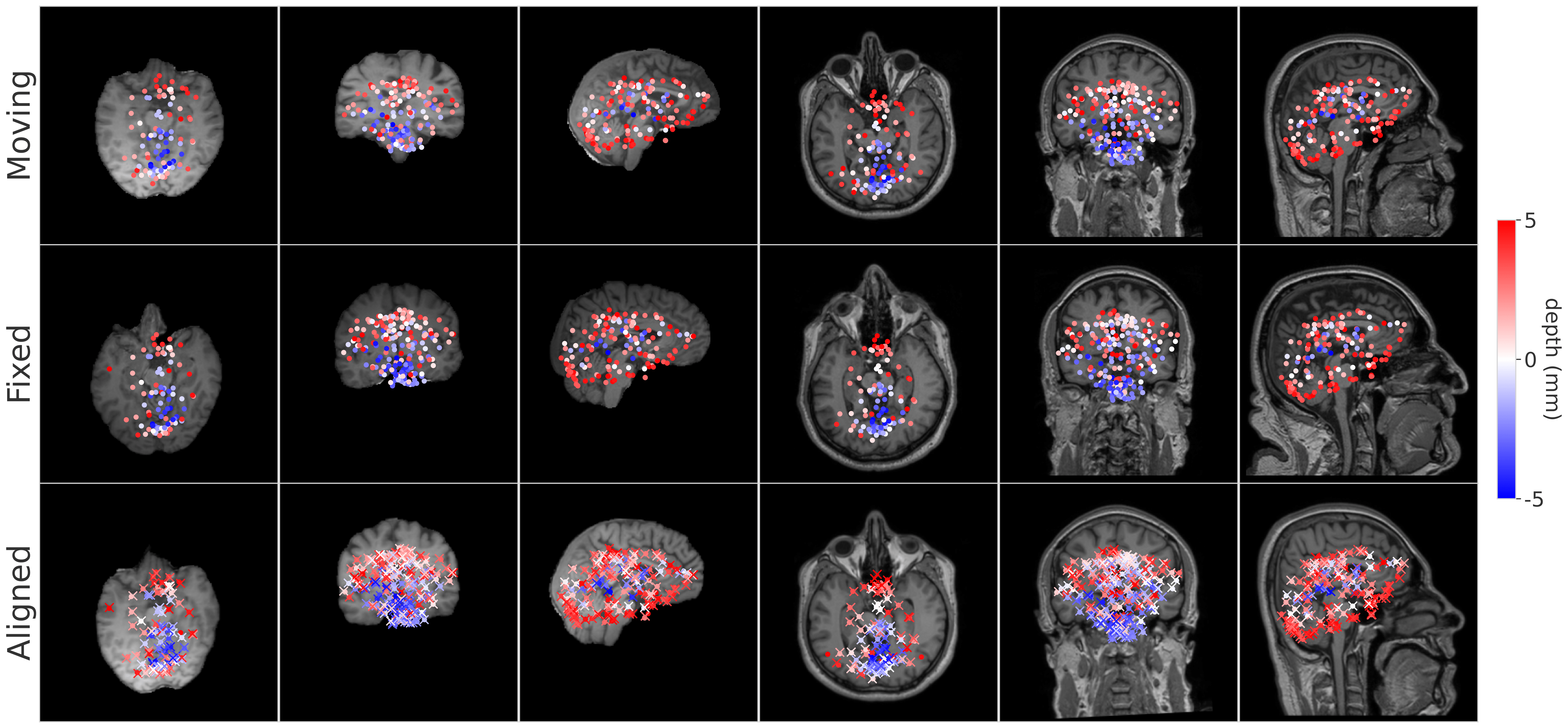 BrainMorph visualization