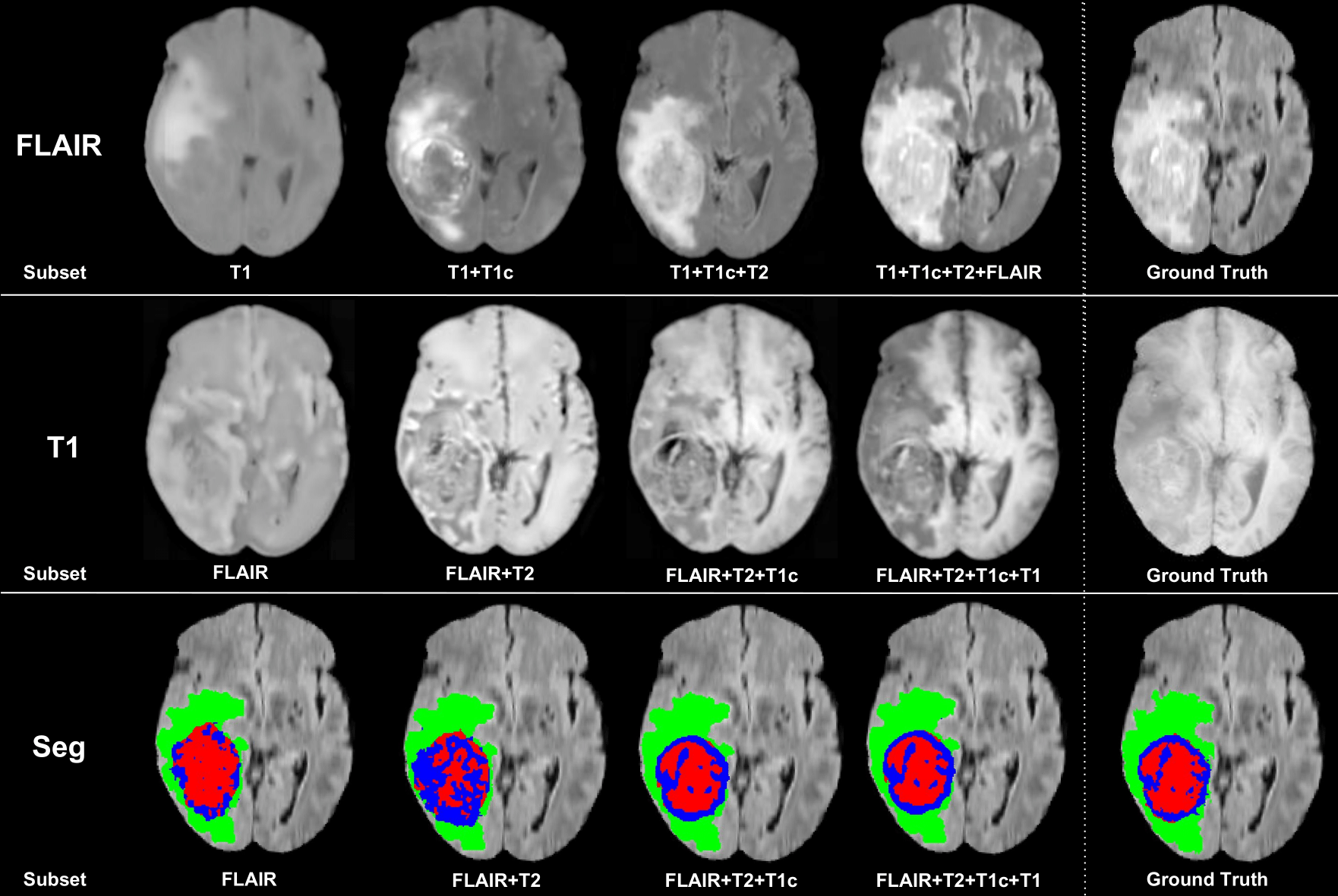 Modality reconstruction and hetero-modal segmentation