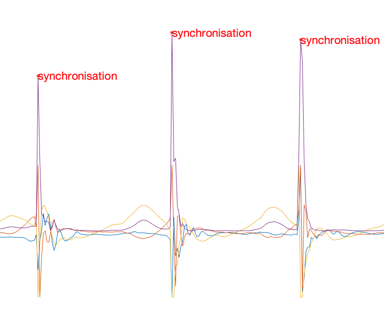 Event Annotations