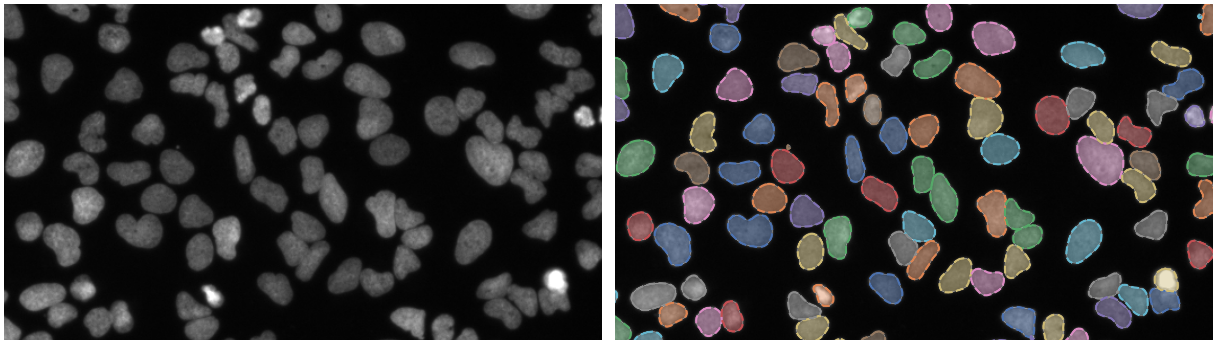 Github Fzj Inm1 Bdacelldetection Scalable Instance Segmentation Using Pytorch And Pytorch