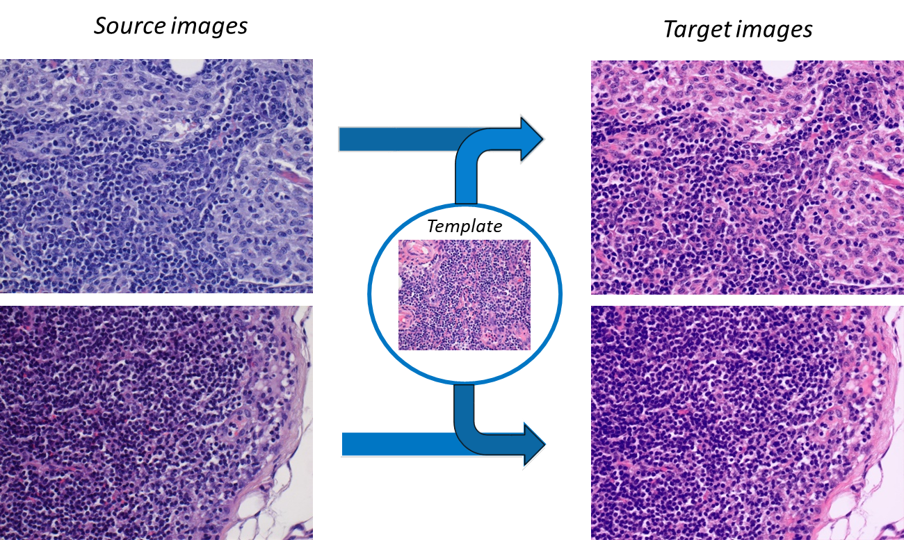 Histopathology Stain Color Normalization