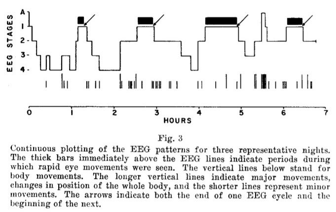 Hypnogram example