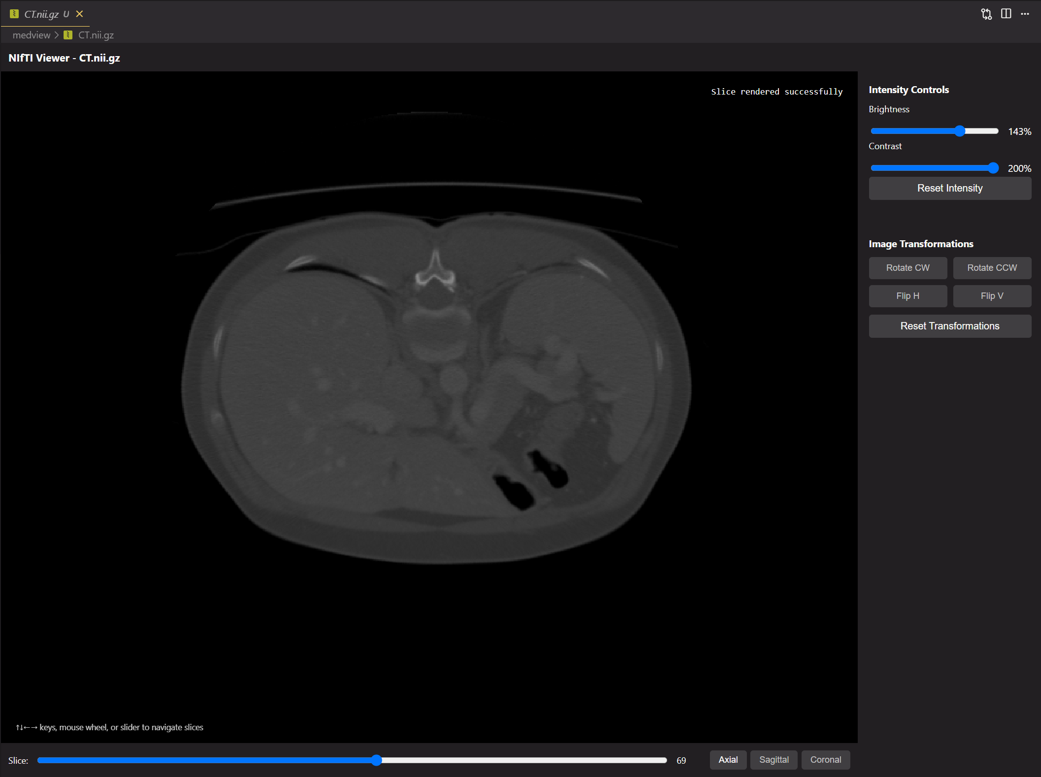 MedView axial view