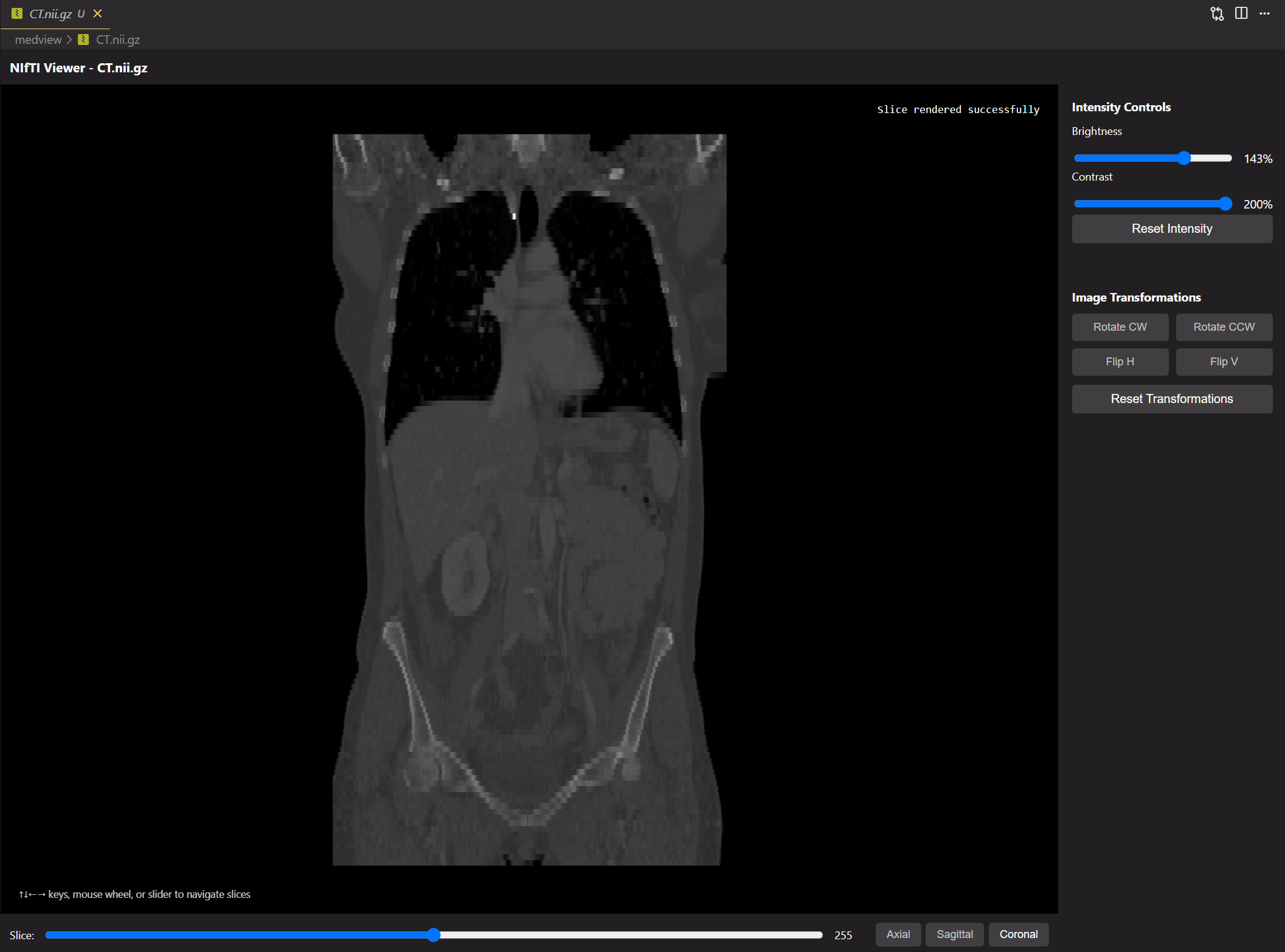 MedView coronal view