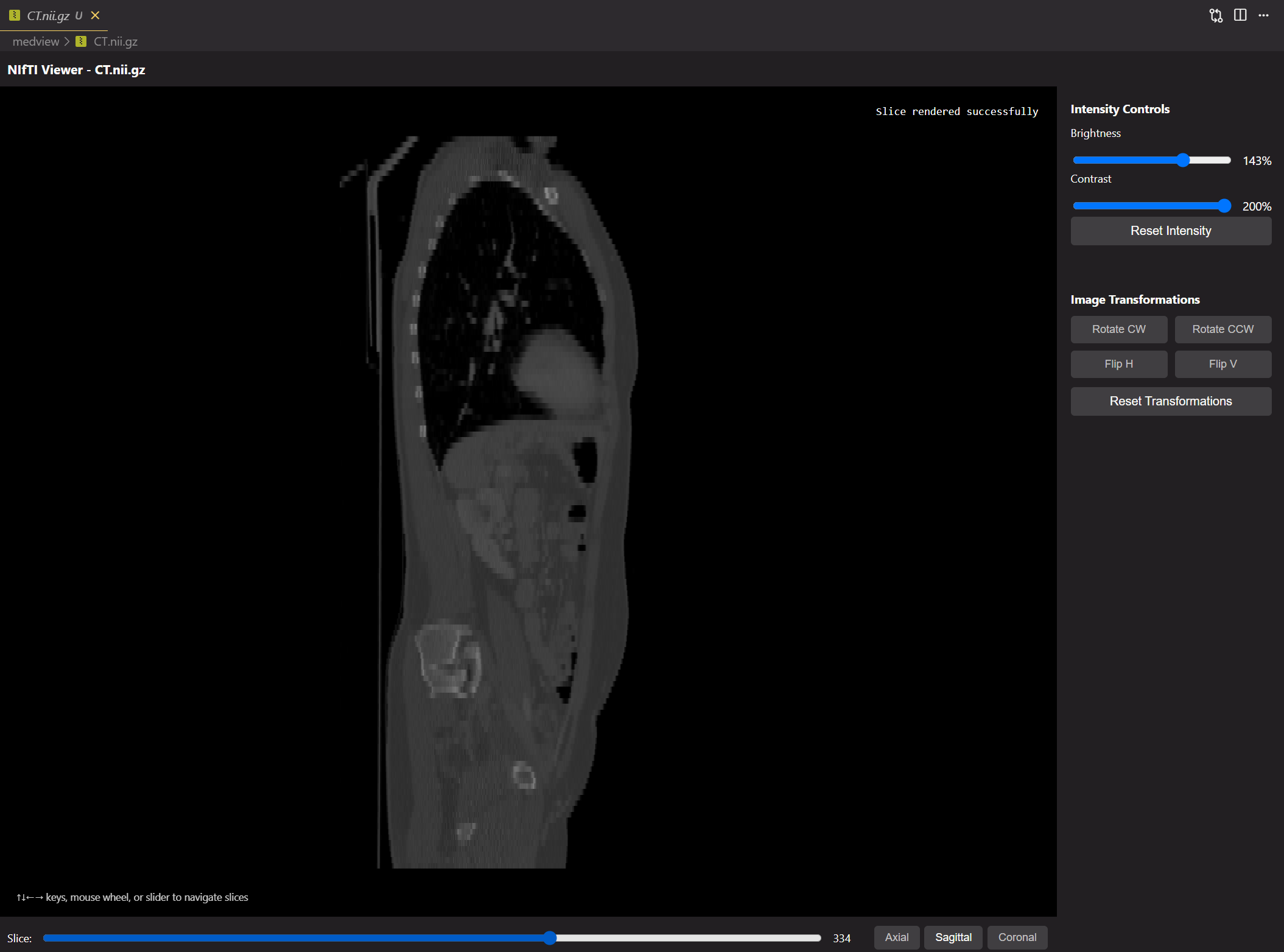 MedView sagittal view
