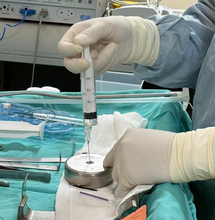 Procedimiento en la Unidad de Tratamiento del Dolor
