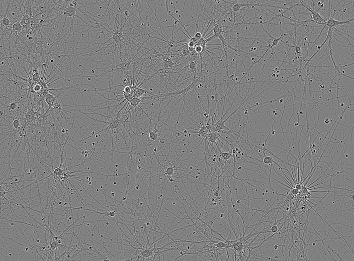 Microscopy image sample in dataset