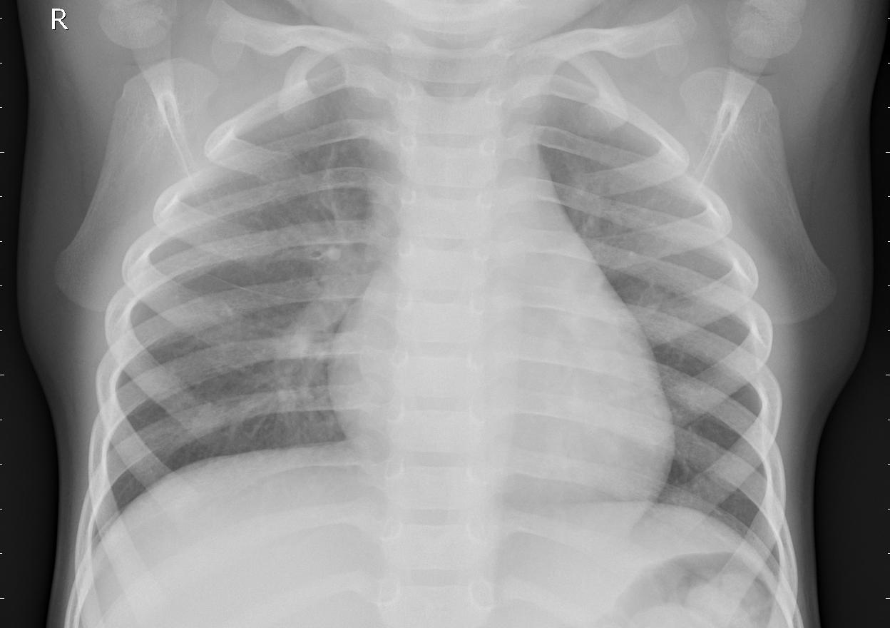 X-ray image in dataset