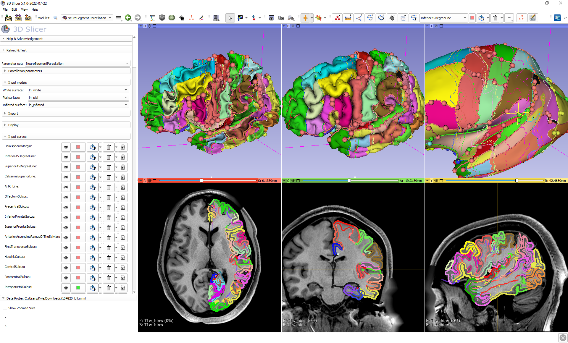 Screenshot of NeuroParcellation extension