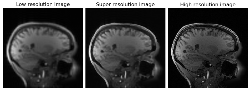 SR examples_images