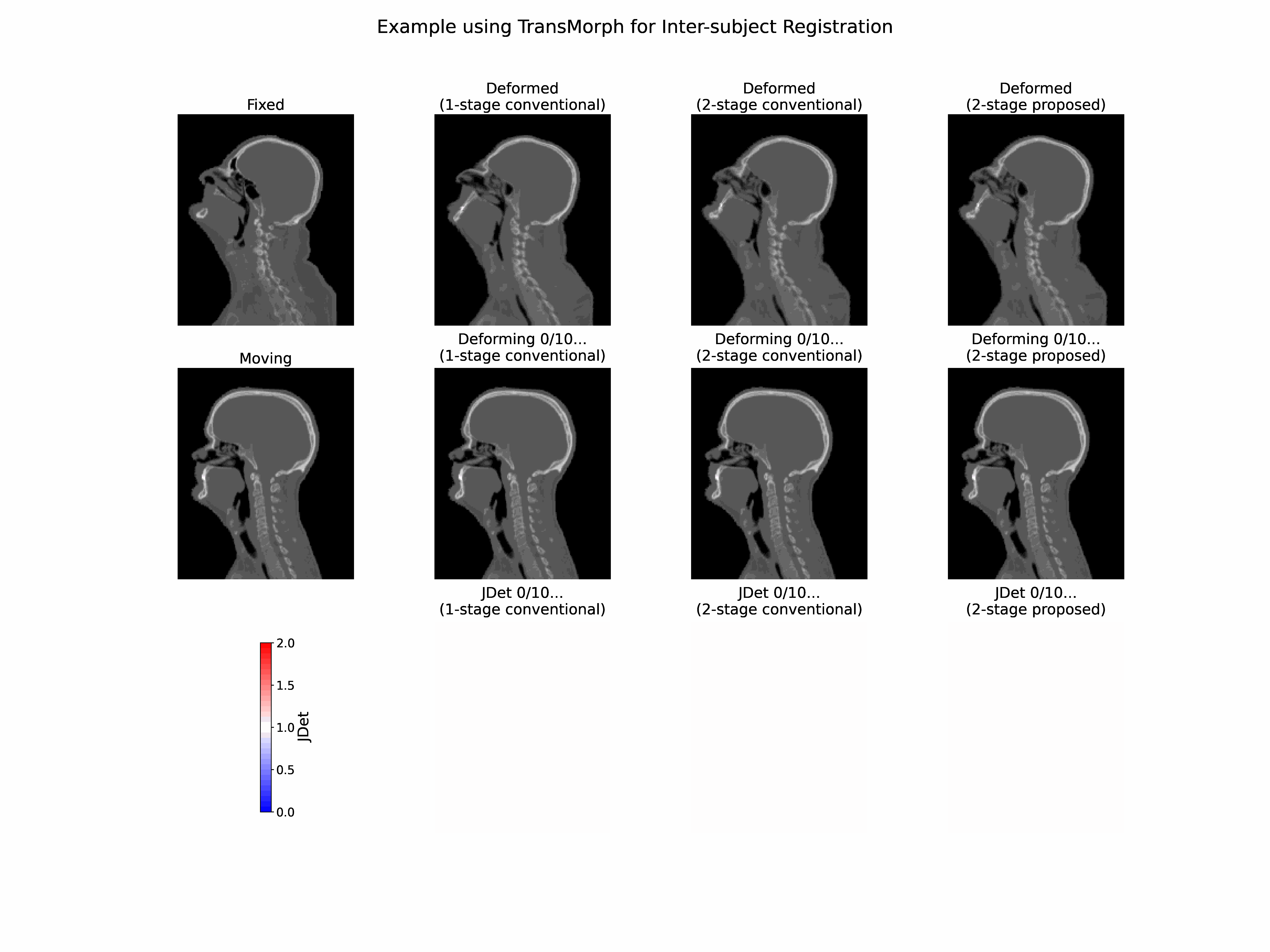 Visualization of MUSA head-and-neck deformable registration and Jacobian determinant