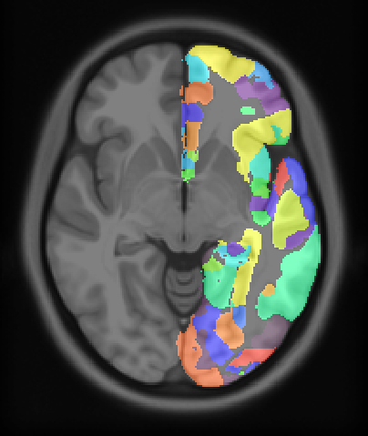 image/julich-brain-l-native-mni152.png