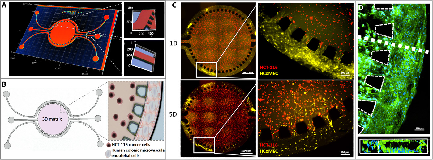 Colorectal tumor-on-a-chip system—A 3D tool for precision onco-nanomedicine