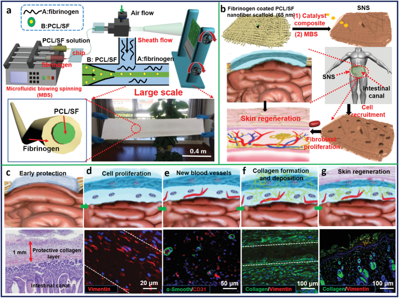 Large‐Scale Fabrication of Robust Artificial Skins from a Biodegradable Sealant‐Loaded Nanofiber Scaffold to Skin Tissue via Microfluidic Blow‐Spinning