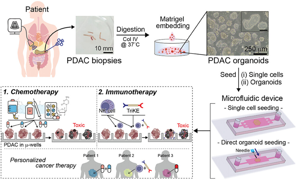 Microfluidic Organoid Cultures Derived from Pancreatic Cancer Biopsies for Personalized Testing of Chemotherapy and Immunotherapy