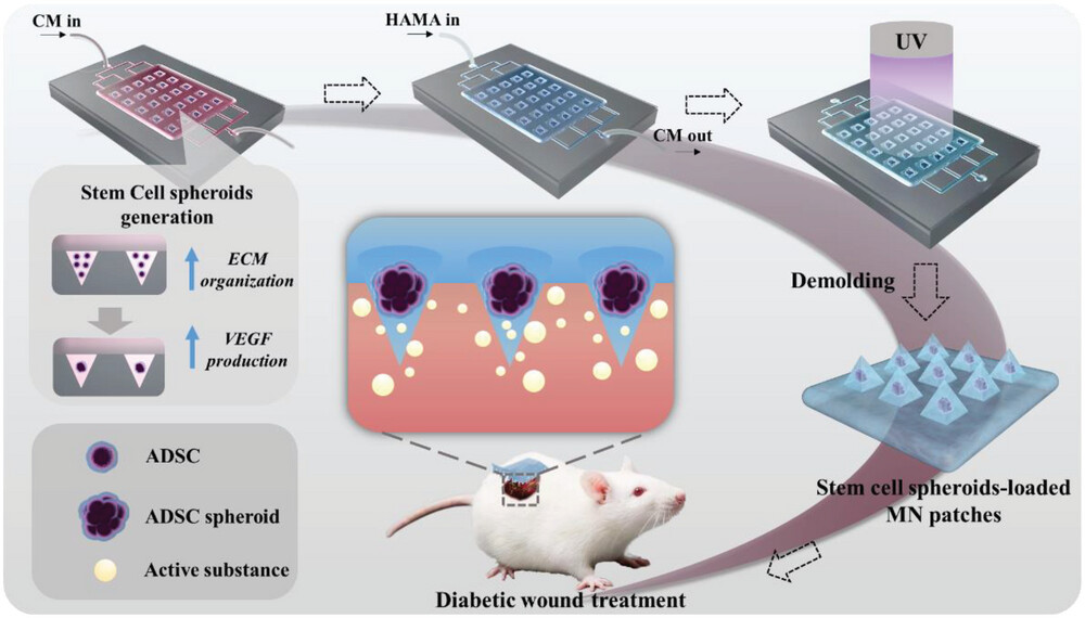 Microfluidic Templated Stem Cell Spheroid Microneedles for Diabetic Wound Treatment