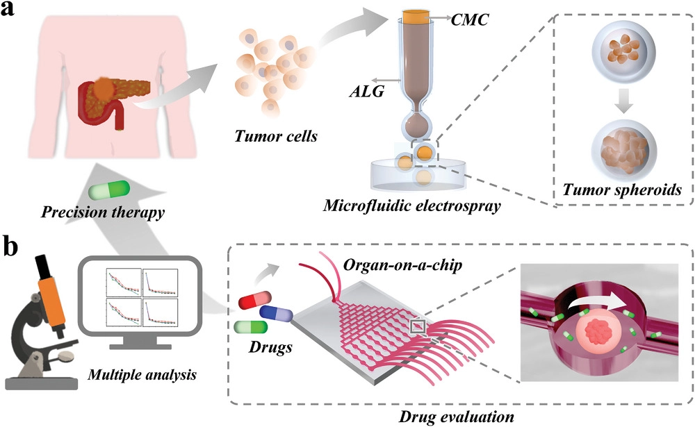 Primary Human Pancreatic Cancer Cells Cultivation in Microfluidic Hydrogel Microcapsules for Drug Evaluation