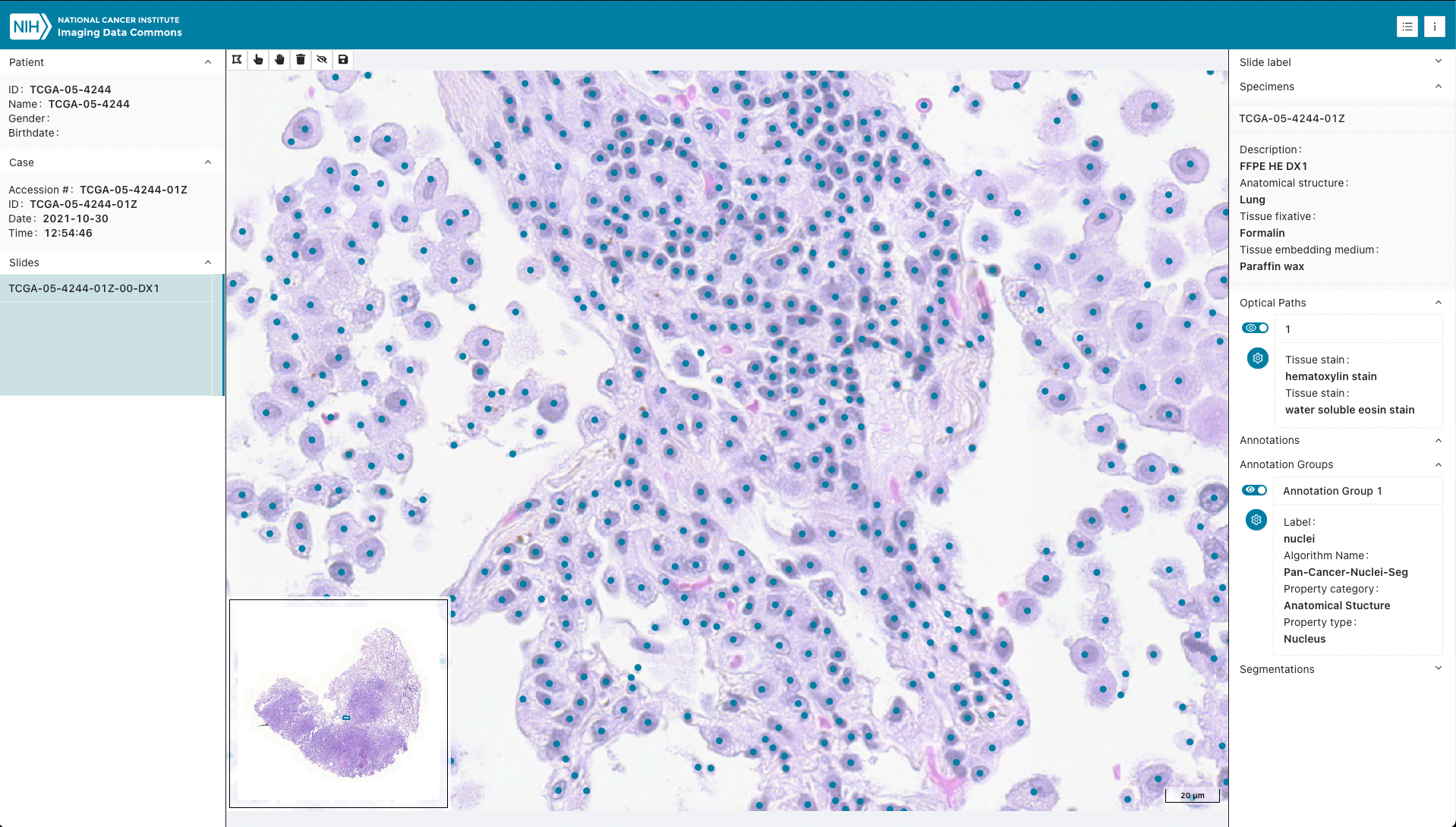IDC TCGA Microscopy Bulk Simple Annotations