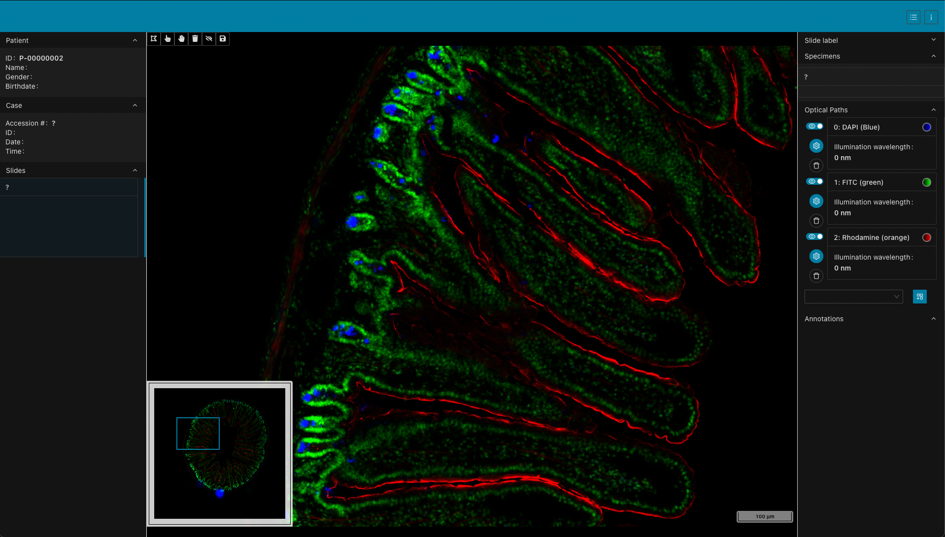 NEMA 3DHISTECH Fluorescence