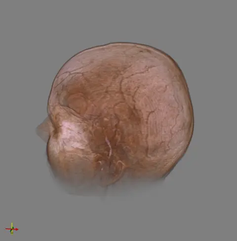 mri_woman