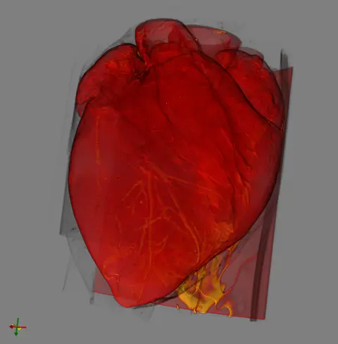 pig_heart