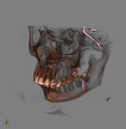 skull