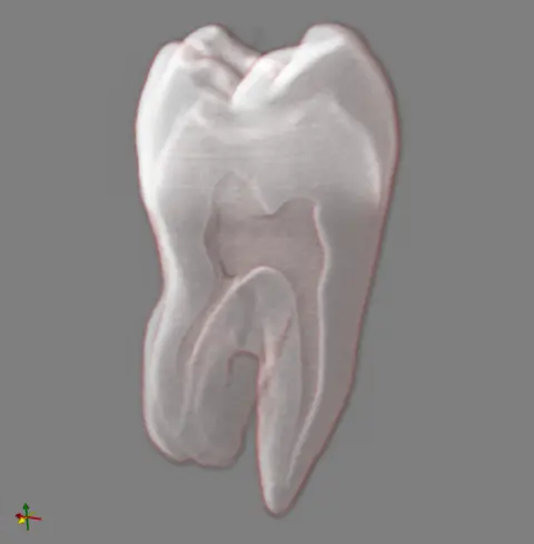 tooth