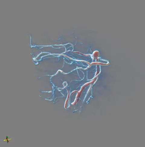 vertebra