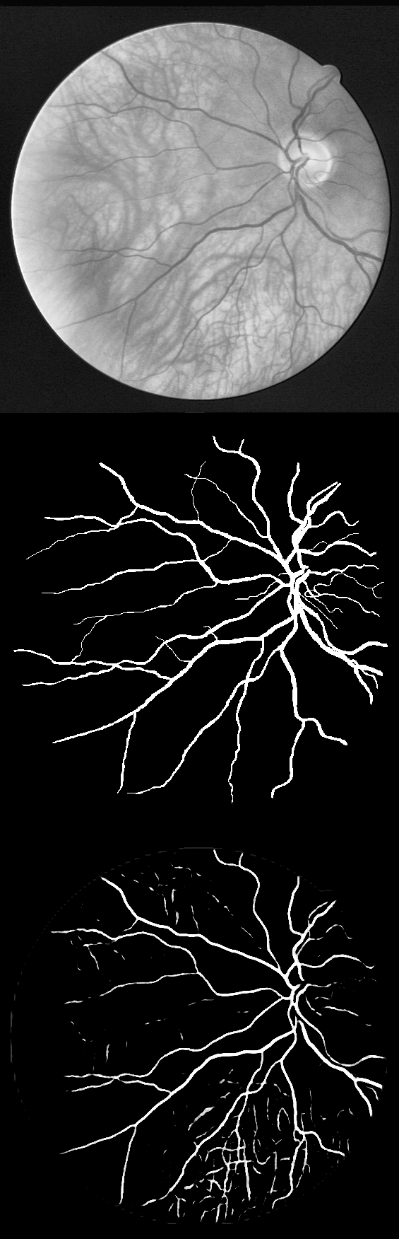 GitHub - Iyed0092/Retinal-Vessel-Segmentation: A vectorized ...