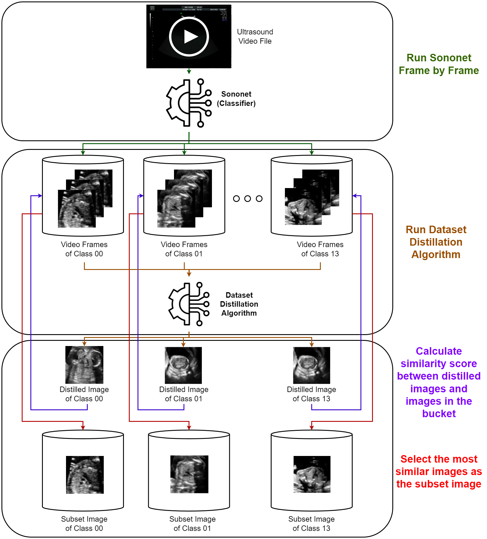 Efficient Ultrasound Video Frame Subset Selection via Generative Dataset Distillation