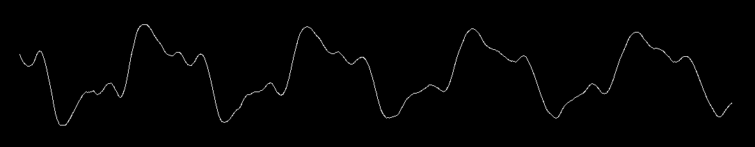 Amplitude mode