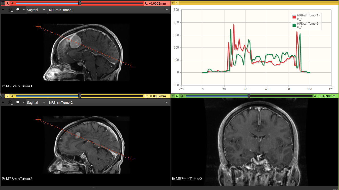 sagittal.PNG