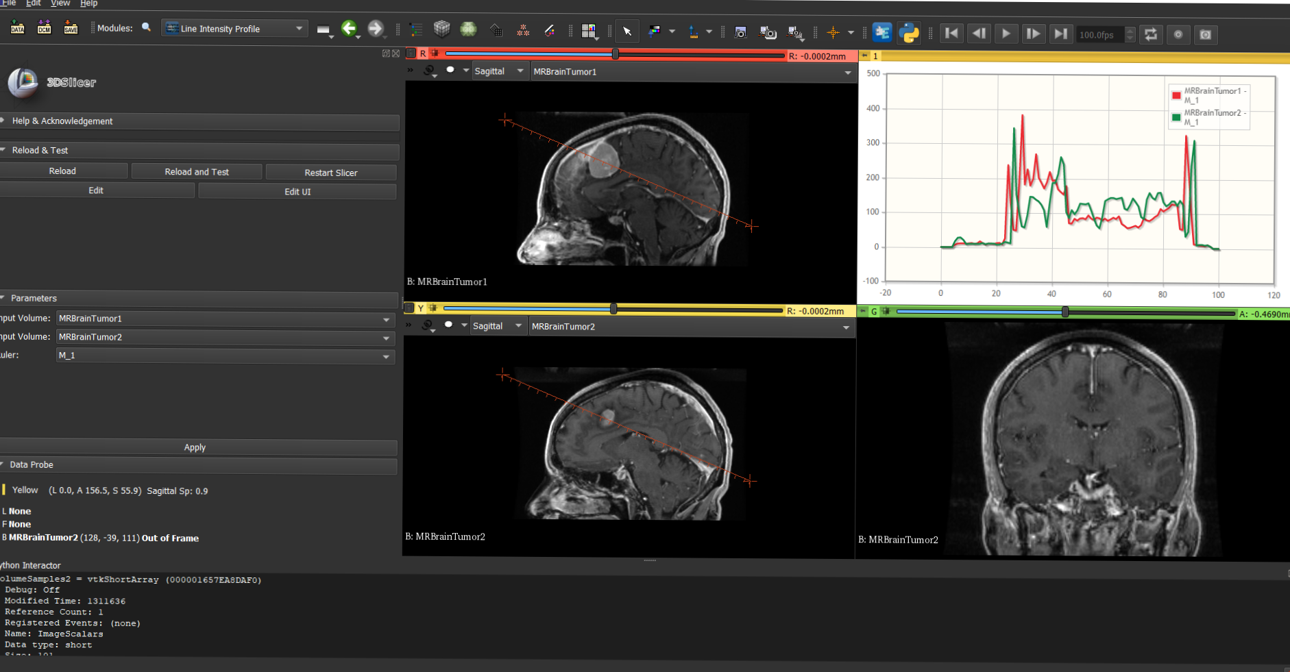                                                     A sample of the Line Intensity Profile extension in 3D Slicer