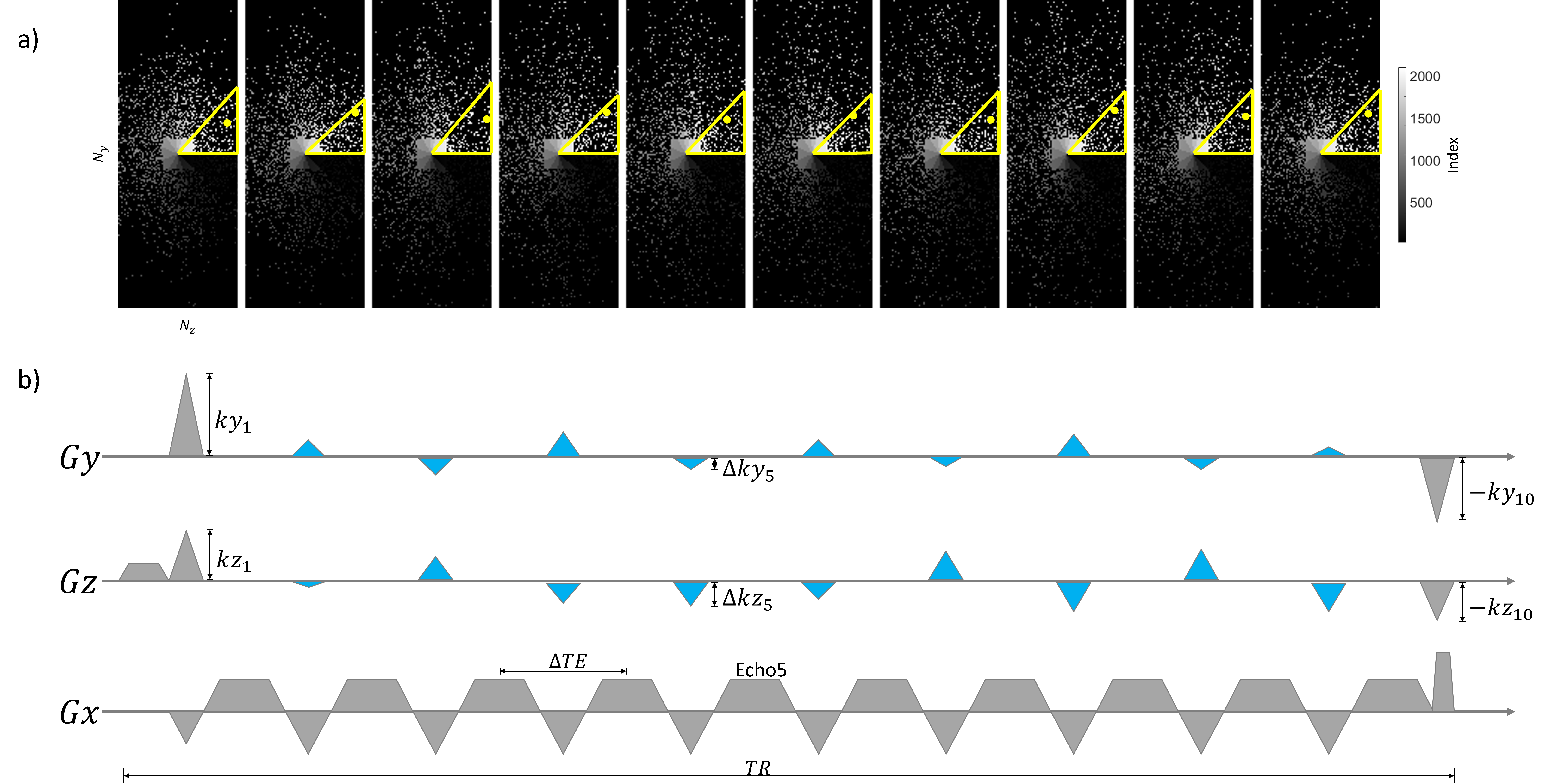 Illustration of (a): the proposed segmented k-space ordering strategy of ten echoes and (b): pulse sequence design.