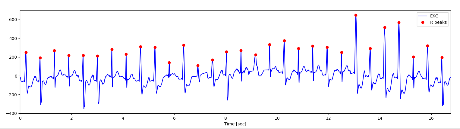 R peak detection from bnormal heartbeat.
